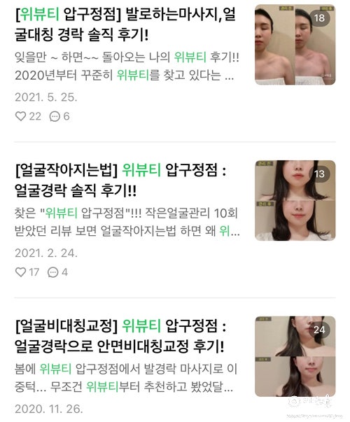 위뷰티에서 발경락으로 턱살빼는법 1