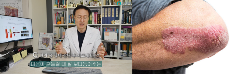 강남 피부한의원, '후기'만 봐도 치료수준을 알 수 있습니다.