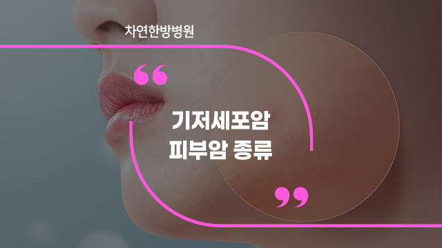  기저세포암 피부암 종류 및 증상