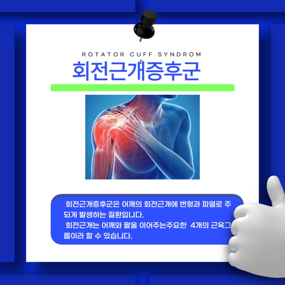 어깨통증! 회전근개 증후군 — 본문 그림