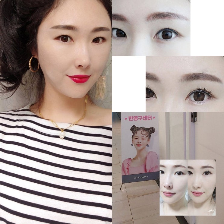  압구정비앤미 얼굴형 맞춤 눈썹문신 역시 자연스러워