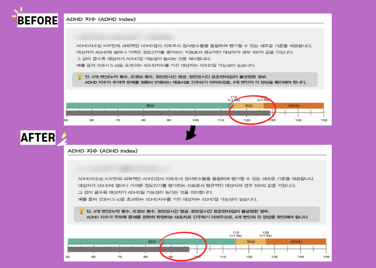 주의력 결핍장애 아동의 자가진단법과 인천 심리상담센터 좋은나무의 치료사례