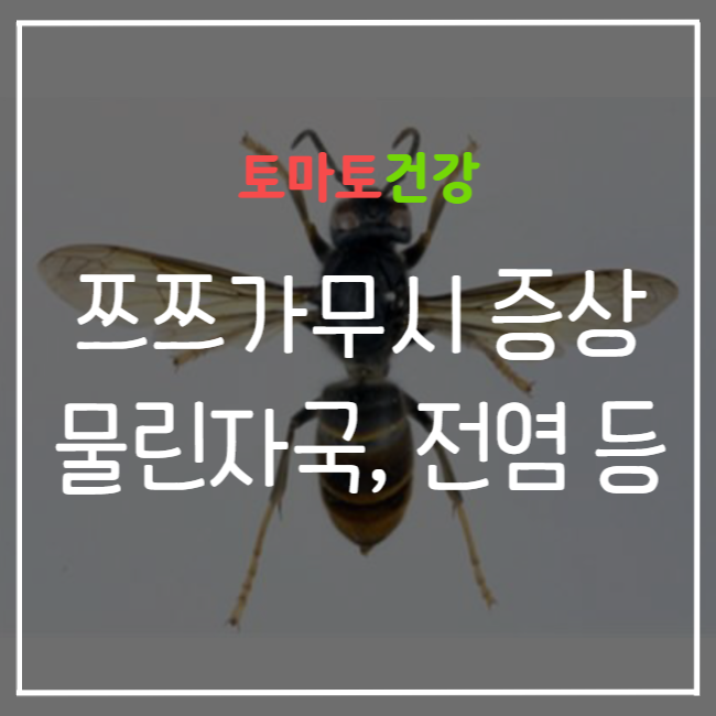  쯔쯔가무시 물린자국, 증상, 치사율, 전염 등 기본 정보