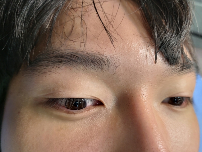  전주 남자속눈썹펌 찌르는속눈썹