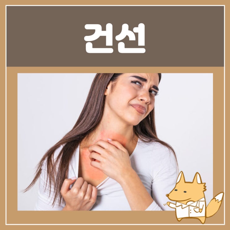  건선 증상 : 피부 건선 증상 건조증 연고 두피 손톱 건선 점상출혈 머리 몸 등 가려움증 얼굴 건선