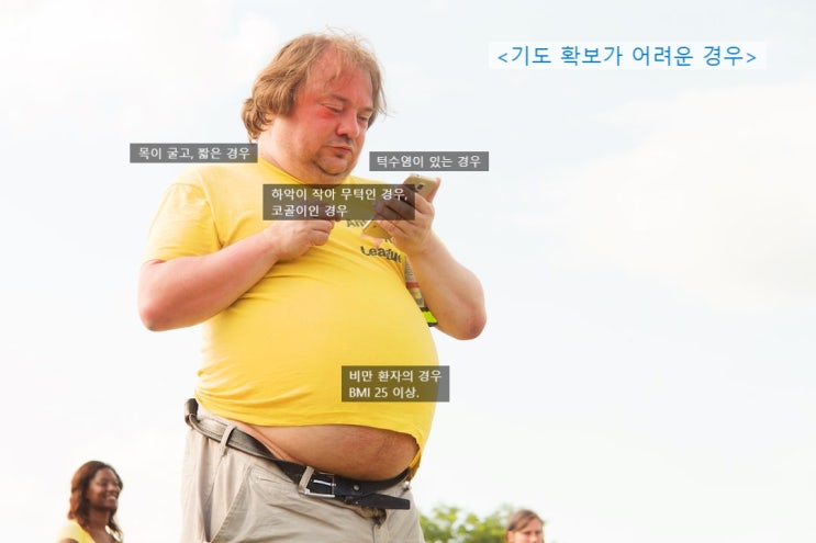  마취/수술 전 기도(airway) 평가에 대해서 : 하는 이유와 기도 평가 방법.