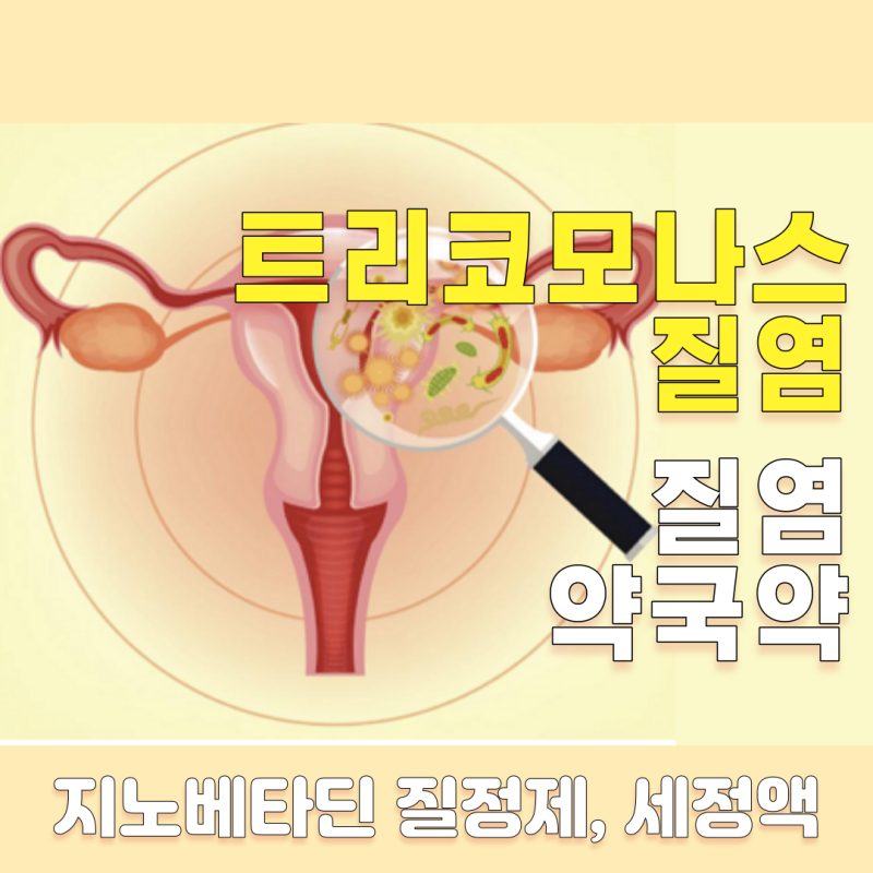 트리코모나스 질염 도움되는 약국약!