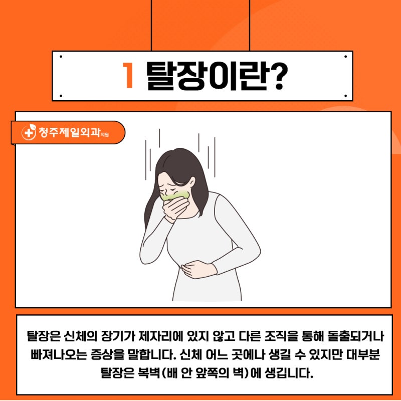 청주 복강경 수술, 서혜부 탈장 방치하면 안 되는 이유!