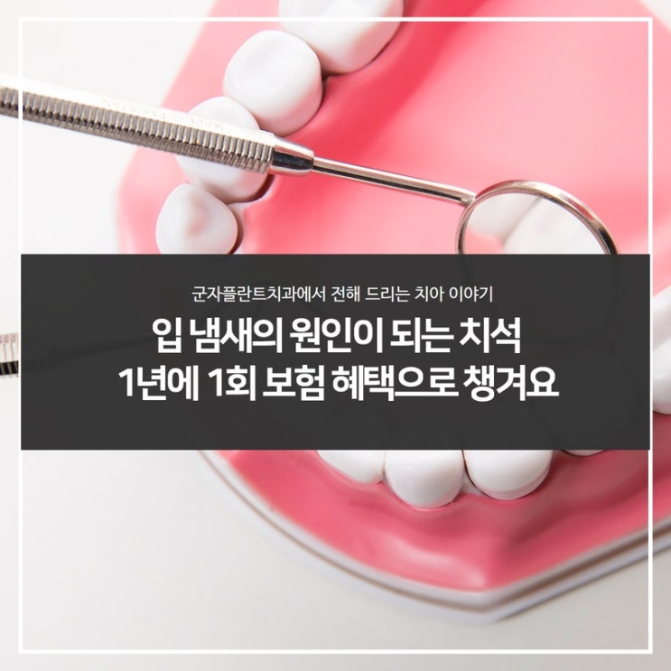 치석으로 인한 입냄새, 스케일링으로 해결했어요