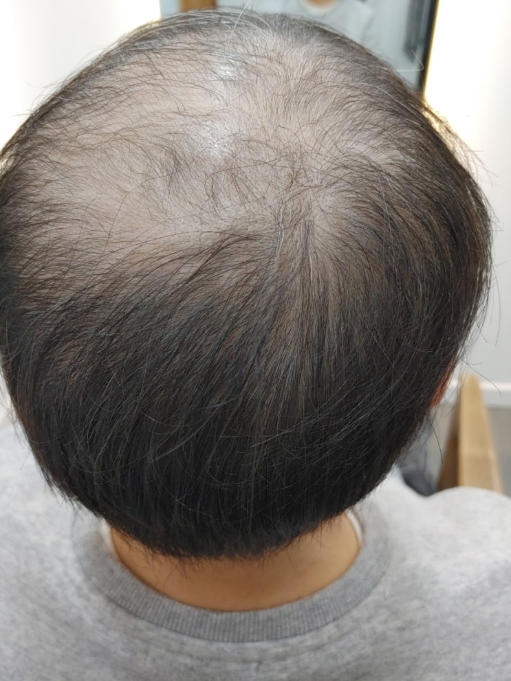  가발러들의 가발커트, 본머리 커트고민 위드위그에서 해결하세요