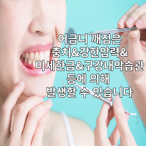 영등포구 치과 어금니 갈라짐의 원인·증상·치료 방법은?