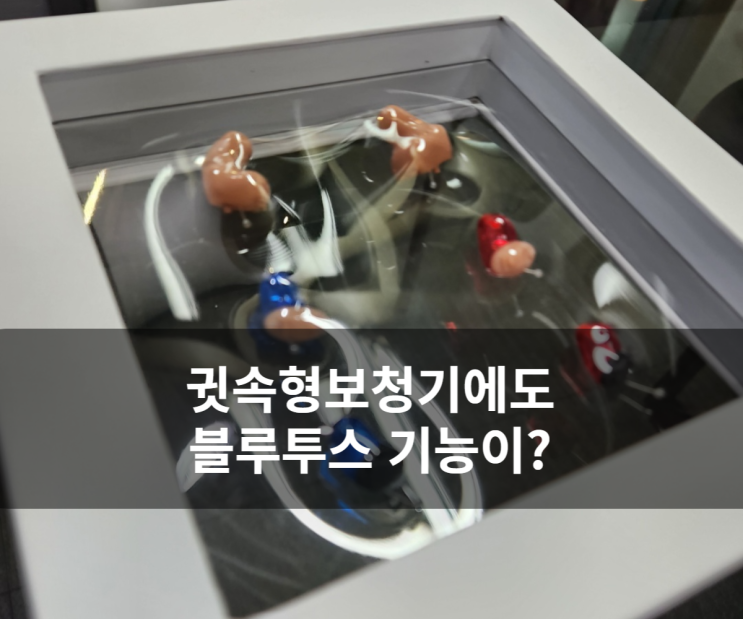  블루투스 기능이 있는 귓속형보청기? [어메이즈17]
