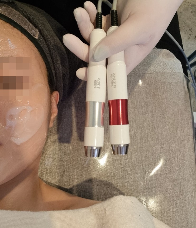  청주피부관리 청주웨딩관리 에스테누누 물방울리프팅 만족후기