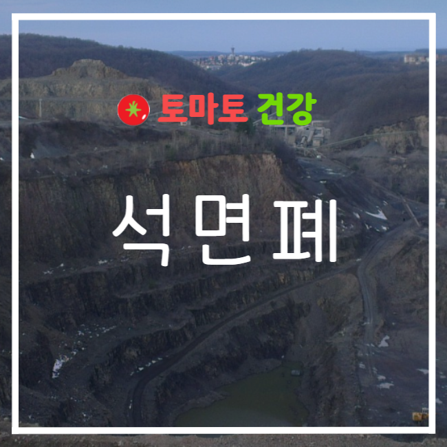  석면폐(석면폐증) A to Z