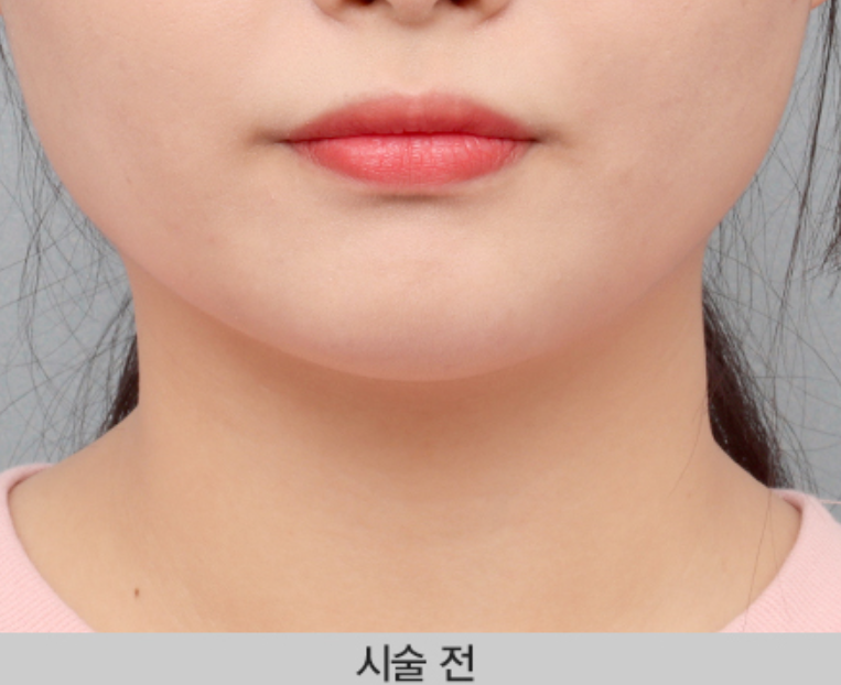 인천 성형외과 추천 꿀팁은 여기에서 확인하세요!