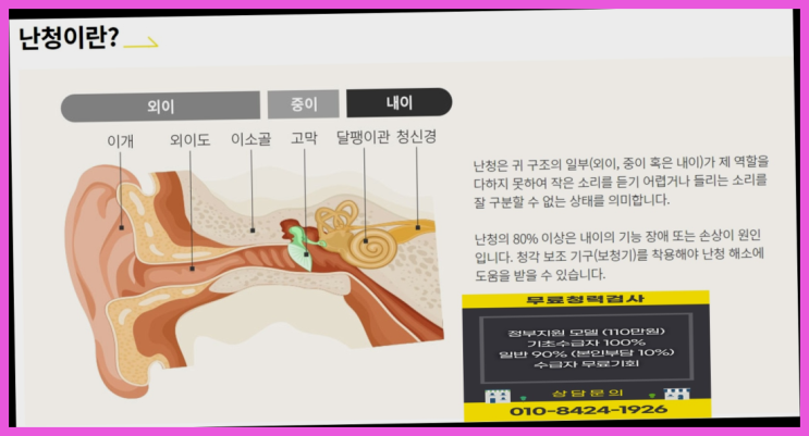  보청기전문  세기보청기가격 국가정부지원 보청기 여기대박