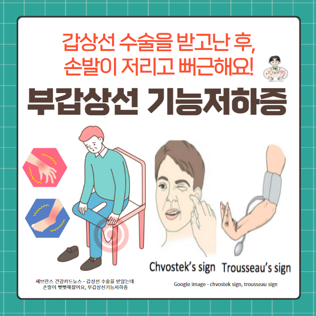  부갑상선(Parathyroid gland) 질환 (2) - 부갑상선 기능저하증(Hypoparathyroidism)