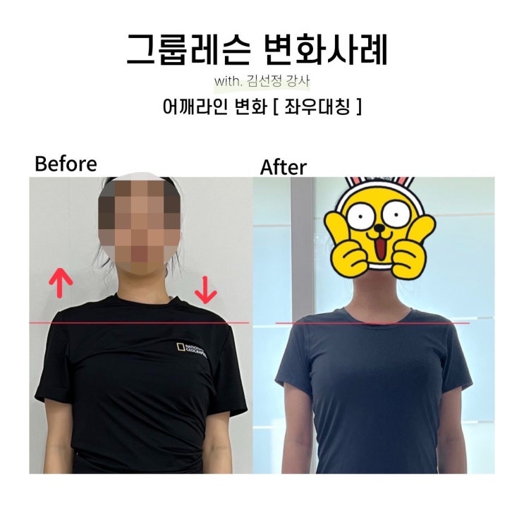  [대구SNPE 리셋바디] 10월 챌린지 어깨라인 변화