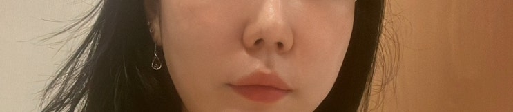  피부과모공관리 청담동 피부과 아토스레이저 3회차 후기 (+ 가격 효과 부작용 )