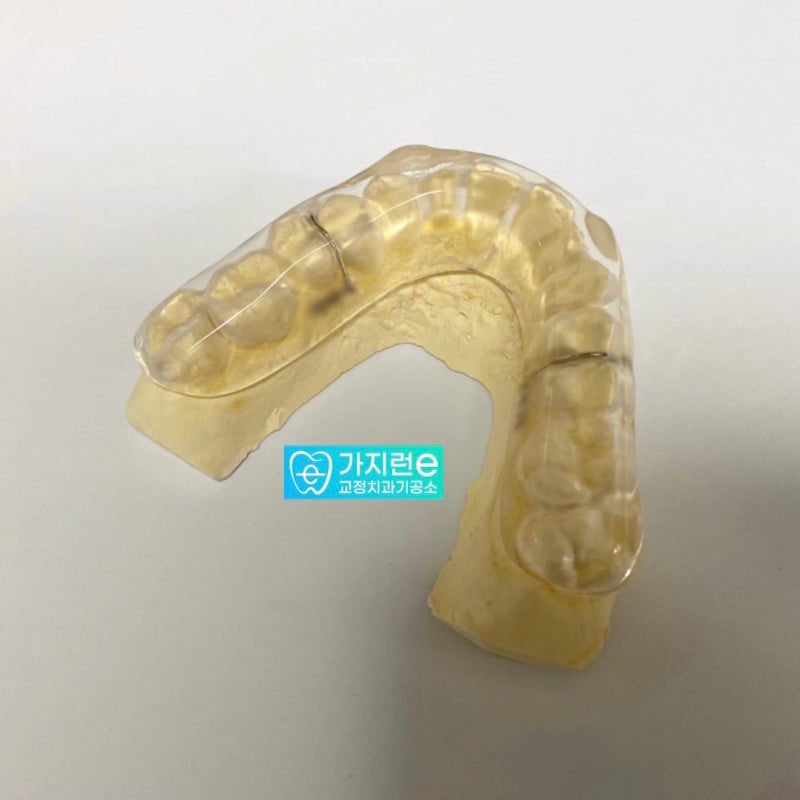 CR Splint 턱관절장치입니다.(스플린트) : 네이버 블로그