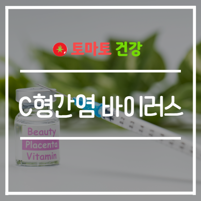  C형 간염 바이러스 제거 성공 사례