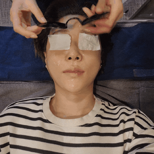  분당 피코슈어 후기(전/후 사진있음)