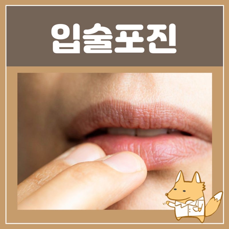 입술 포진치료 구순포진 원인약: 입술 물집 단순포진 헤르페스 원인증상 약 입이 깨졌을 때