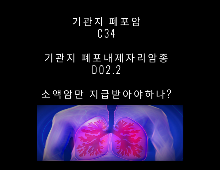 기관지폐포암 상피내암(adenocarcinoma in situ) 질병분류 C34와 D02 분류 논쟁지속중