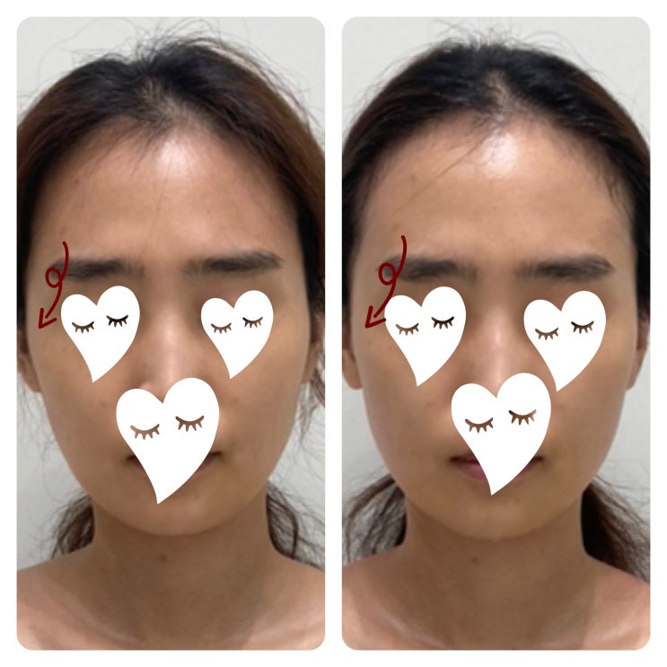  에스테티아 첨단1호점, 나만 알고 싶은 첨단에스테틱 광주윤곽관리