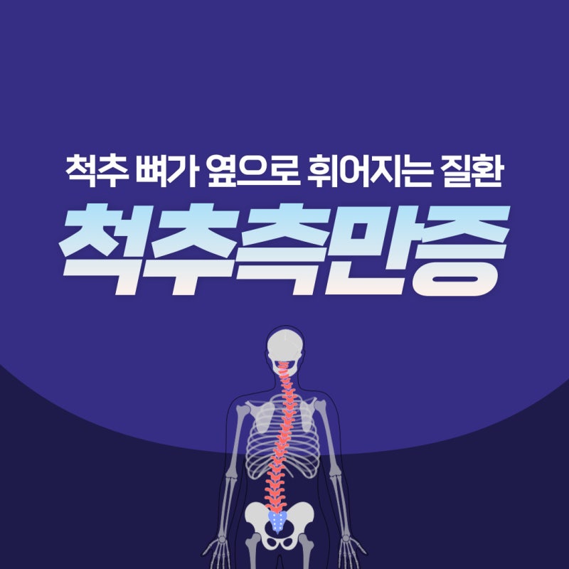 대전동구정형외과는 도수치료를 통해 척추측만증을 개선합니다.