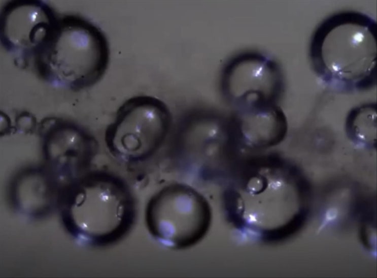 모겔론스들과 마이크로 버블(Micro Bubble)