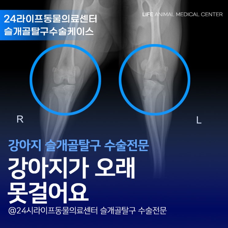 대구 강아지 슬개골탈구 수술 : 강아지가 자꾸 주저 앉아요 슬개골탈구 3기 수술