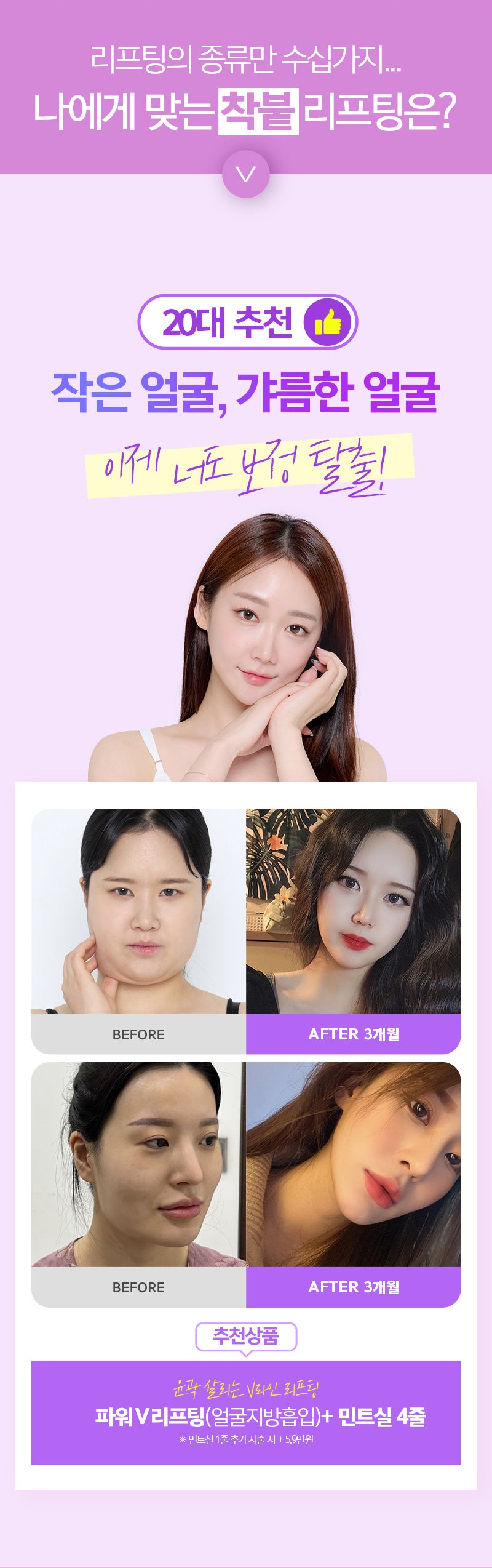 40대부터 꼭 필요한 리프팅시술, 2
