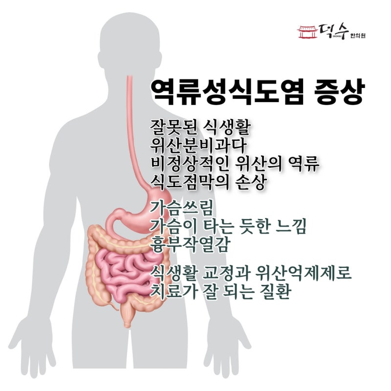 인후통 증상과 역류성 식도염을 돕는 방법 4