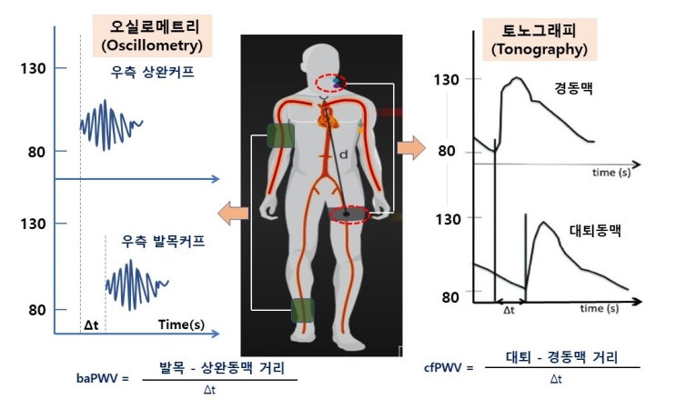 맥파전달속도(PWV, Pulse wave velocity)와 동맥경직도(arterial stiffness),  운동과 맥파의 발생