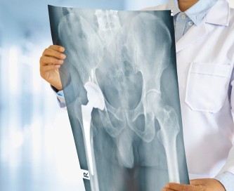 고관절골절수술비용, 이 글로 정리해 드립니다 : 네이버 블로그