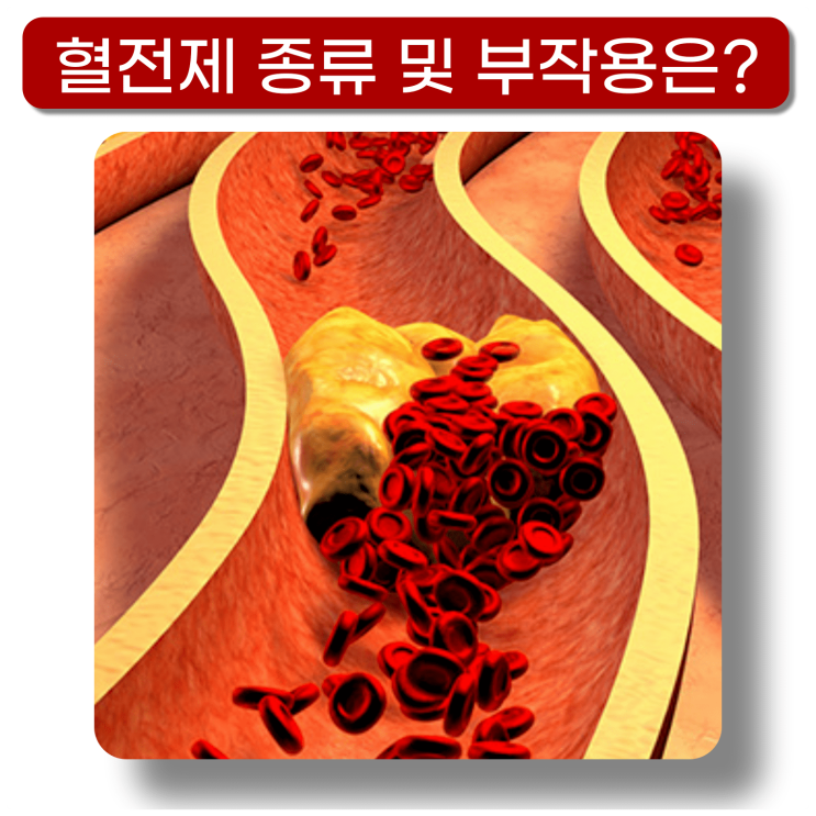  혈전제 종류 부작용