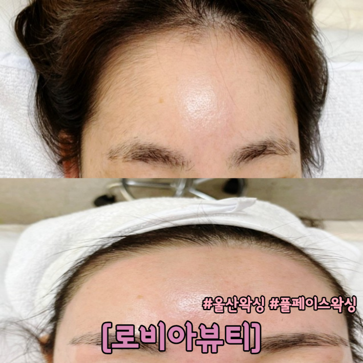  울산 신정동 왁싱 풀페이스 왁싱 로비아뷰티에서 피부톤업 시켜요