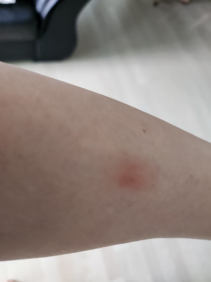 겨울이 오는데 실내에 모기가 많네요