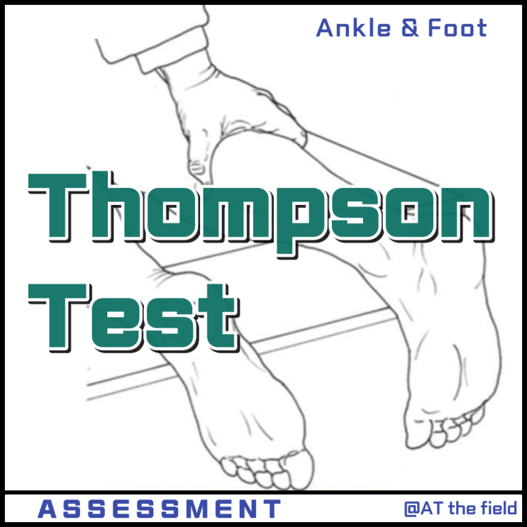 Thompson Test / 톰슨 검사/ Calf compression test, Simmonds test ,아킬레스 건 파열 검사, 아킬레스 힘줄 파열 검사