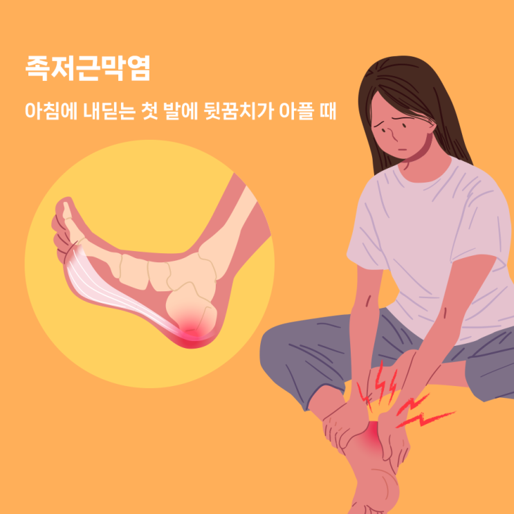  송파구정형외과 족저근막염, 아침에 내딛는 첫 발에 뒷꿈치가 아플 때