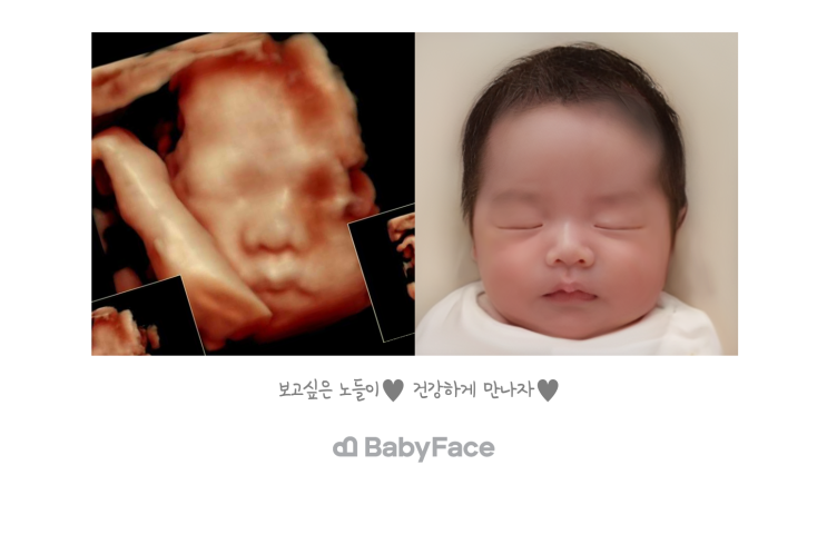  [임신기록] 26주 입체초음파 베이비페이스 후기