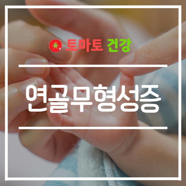  연골무형성증 기본정보 및 아기 유전 가능성