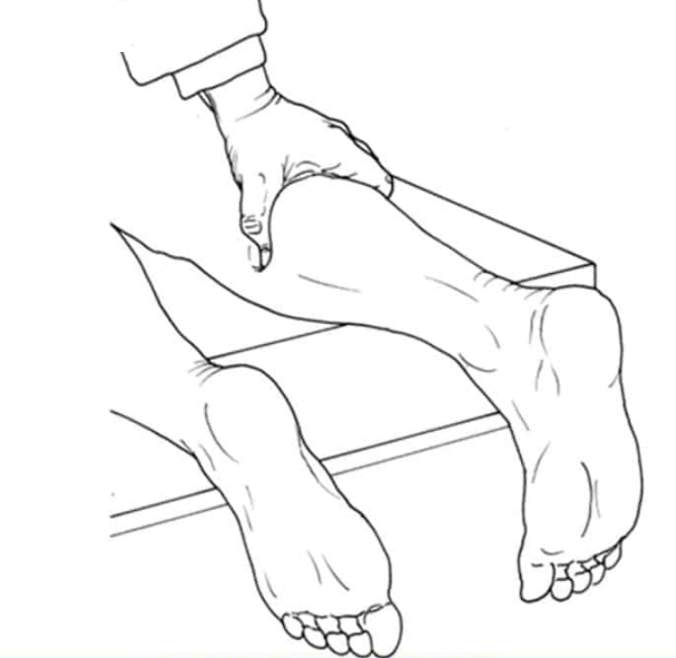 Thompson Test / 톰슨 검사/ Calf compression test, Simmonds test ,아킬레스 건 파열 ...