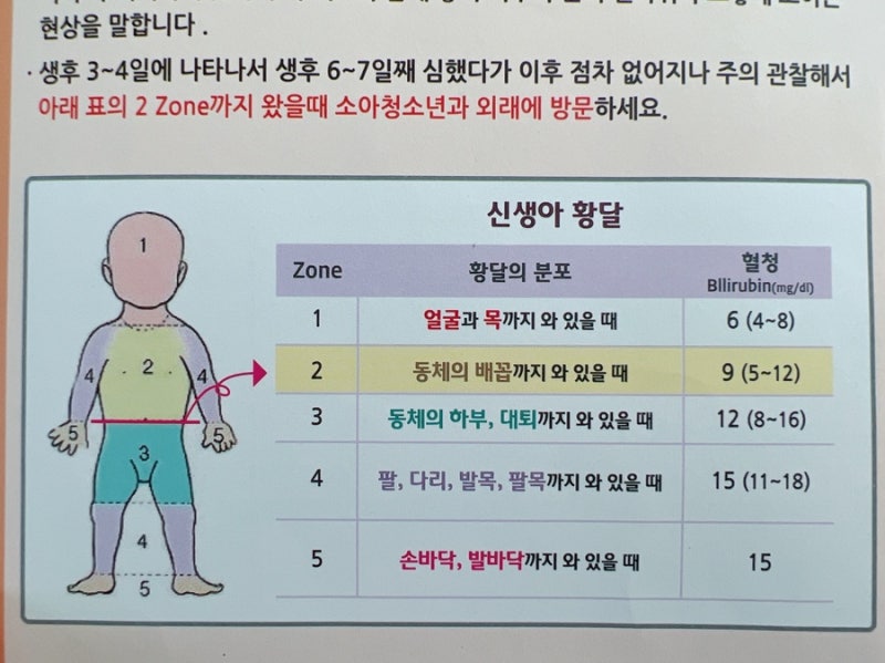 신생아 황달 증상 수치 아기황달 원인 (눈흰자 노란색) : 네이버 블로그