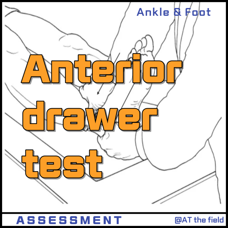 Anterior drawer test / 발목 전방전위 검사/ankle special test/ATFL 손상 검사, 발목 불안정성 이학적 검사