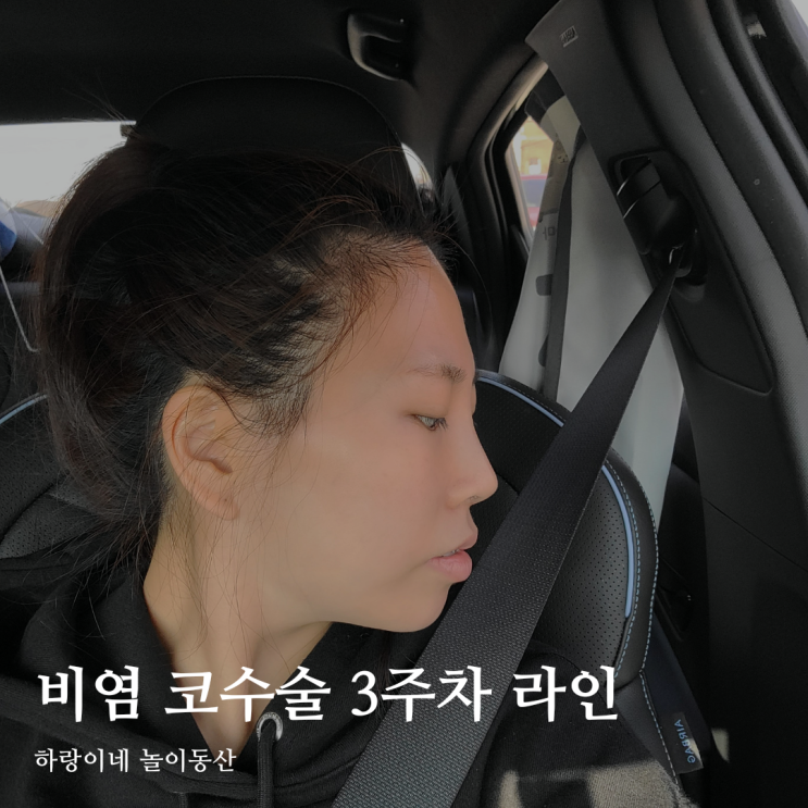  실비 코성형 3주차 라인 비염수술 후 모양