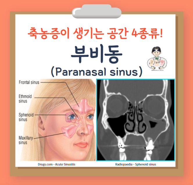  축농증이 생기는 공간 '부비동(paranasal sinus)' 4종류! - 상악동, 사골동, 전두동, 접형동