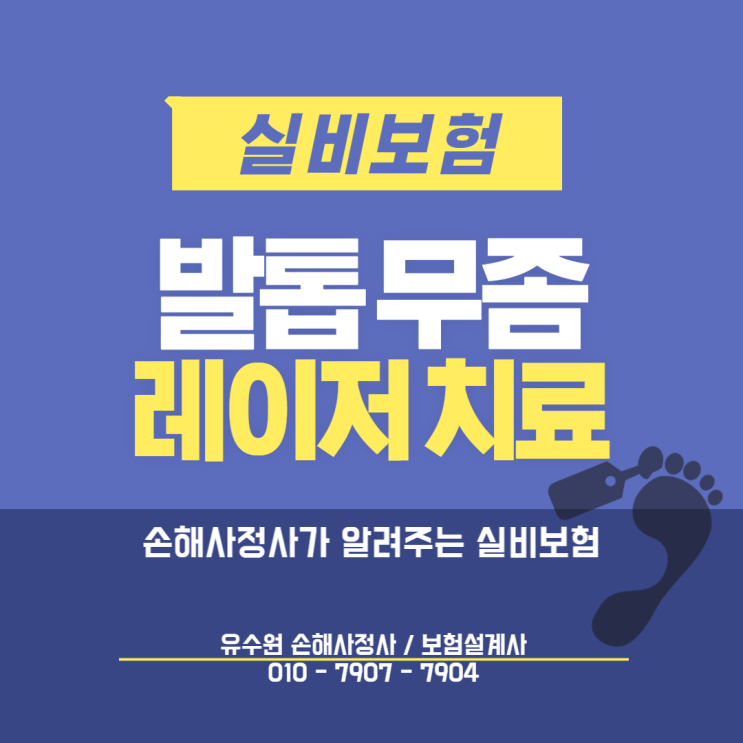  발톱무좀 레이저 치료 과연 실비보험 적용될까?