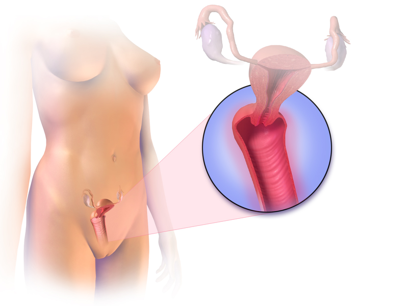 질염한의원 청담선한의원 만성질염치료 가드넬라질염치료